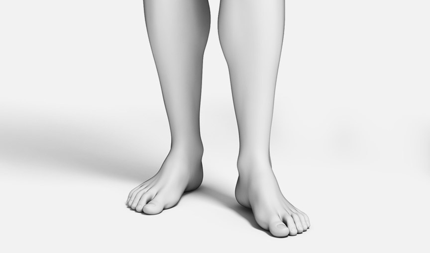 하지정맥류 수술 하지정맥류